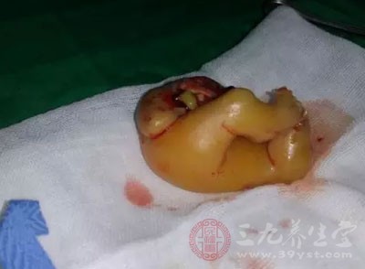 冒口笼罩剂的感化‘bsport必一运动’(图1) bsport必一运动